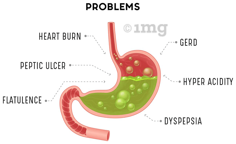 Acidinol |Improves Digestion and Helps in Acidity and Bloating | Syrup