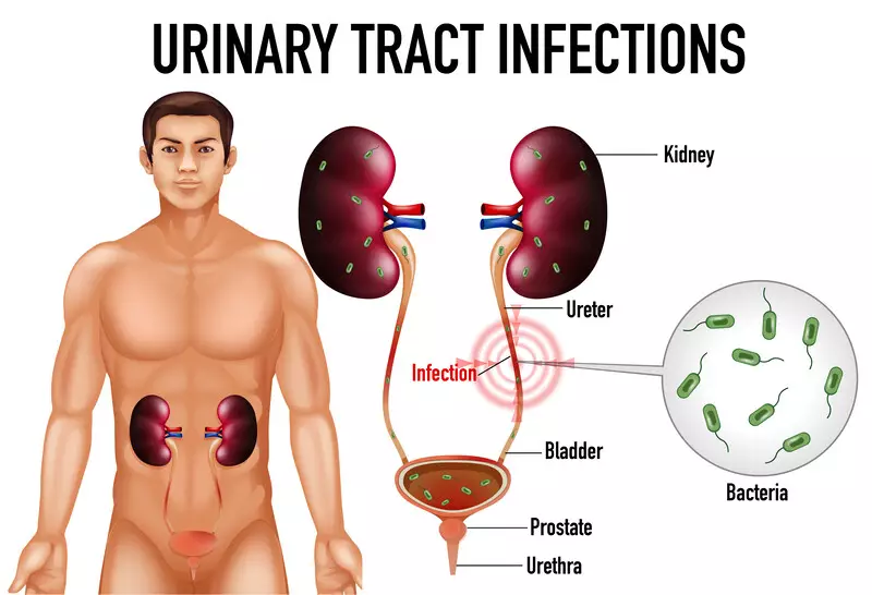 bladder-cancer-staging