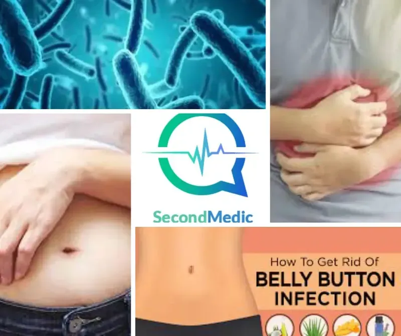 Belly Button Infections Causes Prevention Symptoms And Treatment