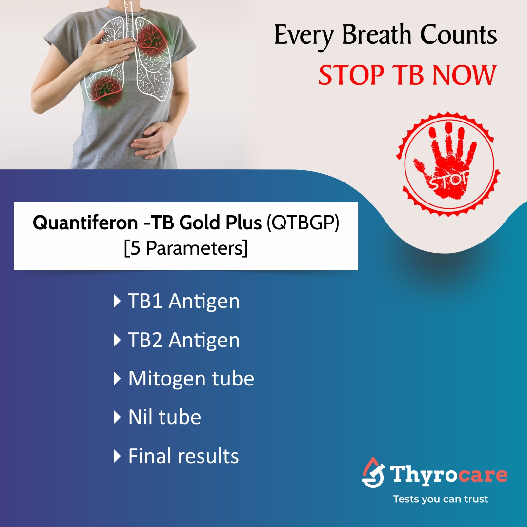 QUANTIFERON -TB GOLD PLUS